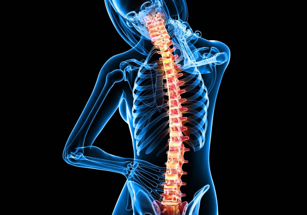 Spinal-stenosis-1